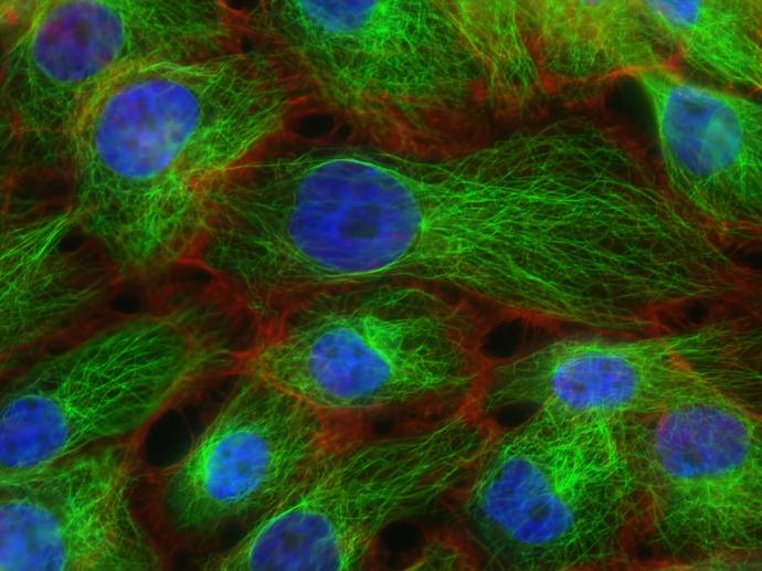 Functional Characterization of Conserved Regulators in Normal and Cancer Stem Cells