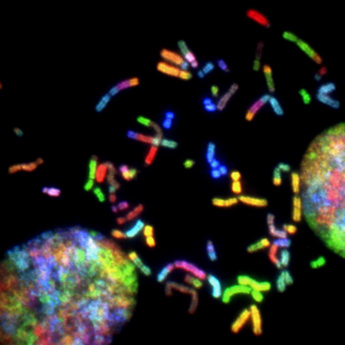 Unequal protein damage partitioning during asymmetric stem cell division determines the differential lifespan of progeny