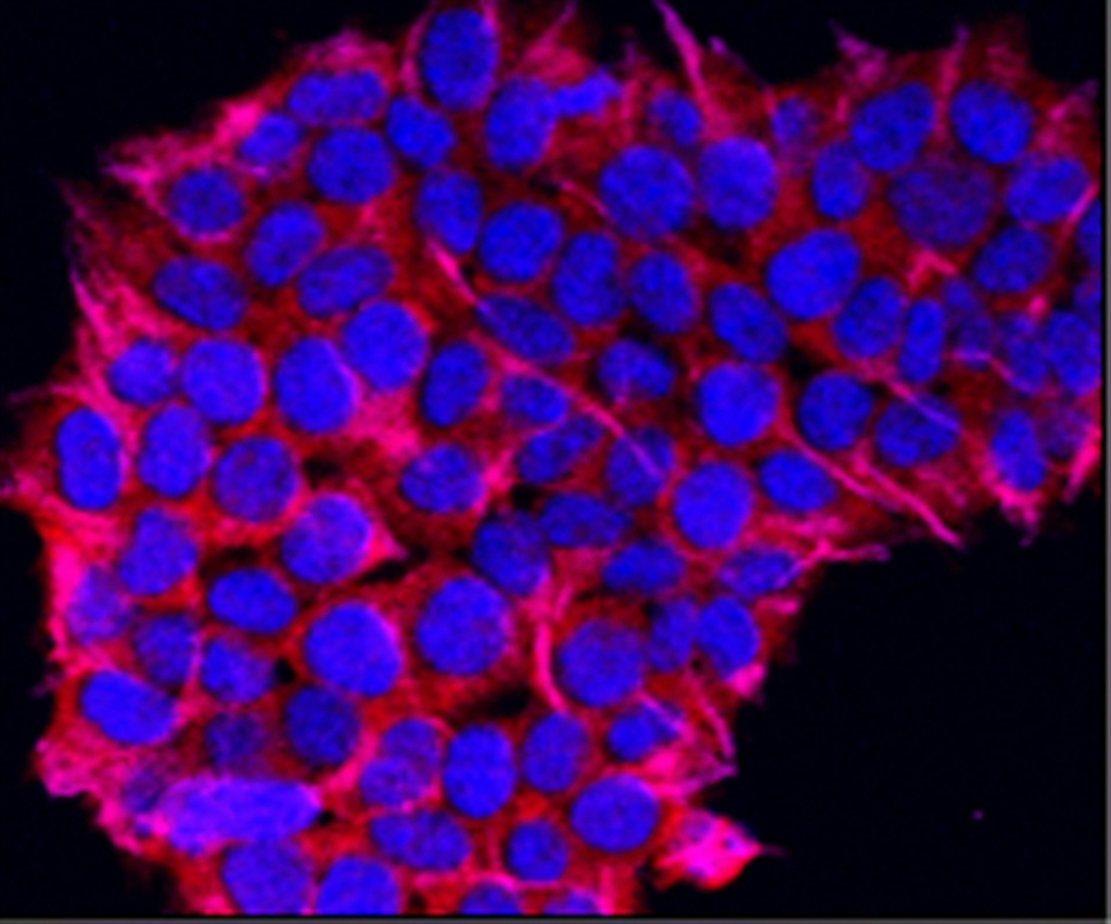 Molecular regulation of muscle stem cell function in regenerative myogenesis