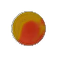 Burkholderia Cepacia Agar (BCSA)  Pack of 20 plates