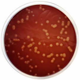 Brain Heart Infusion Agar (BHI Agar)  500grams