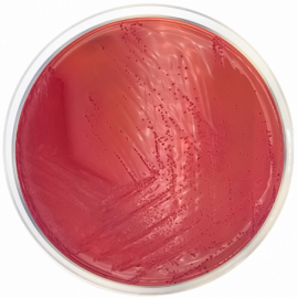 Yersinia Selective Agar Base (CIN)  ISO500grams