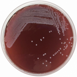 Tryptose Blood Agar Base 500grams