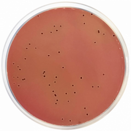 Modified Salmonella Shigella Agar 500grams