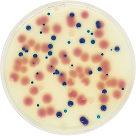 Urinary Tract Infections Chromogenic Agar (UTIC) 500grams