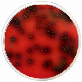 [1141] Listeria Agar Base Palcam ISO 500grams